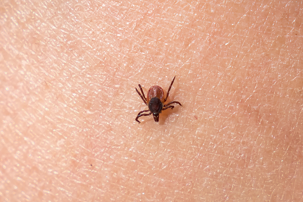 Tick crawling on human hand, 123RF, andriano